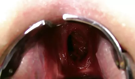 او عکس کون و کس سکسی یک ملاقات سکسی کت گارسیا دارد